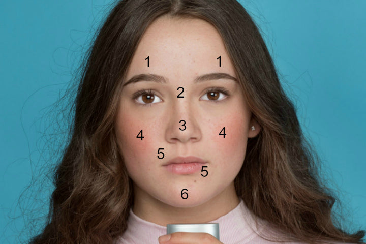 acne face mapping for teen-prone skin