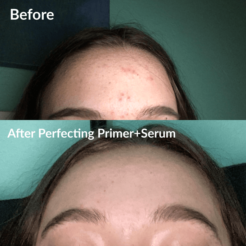 Fiona Frills Makeup Perfecting Primer+Serum | Clear Skin Serum Frilliance